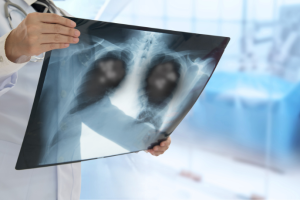 Dra. Thaline Neves explica como o contraste em exames de imagem potencializa a precisão dos diagnósticos médicos.